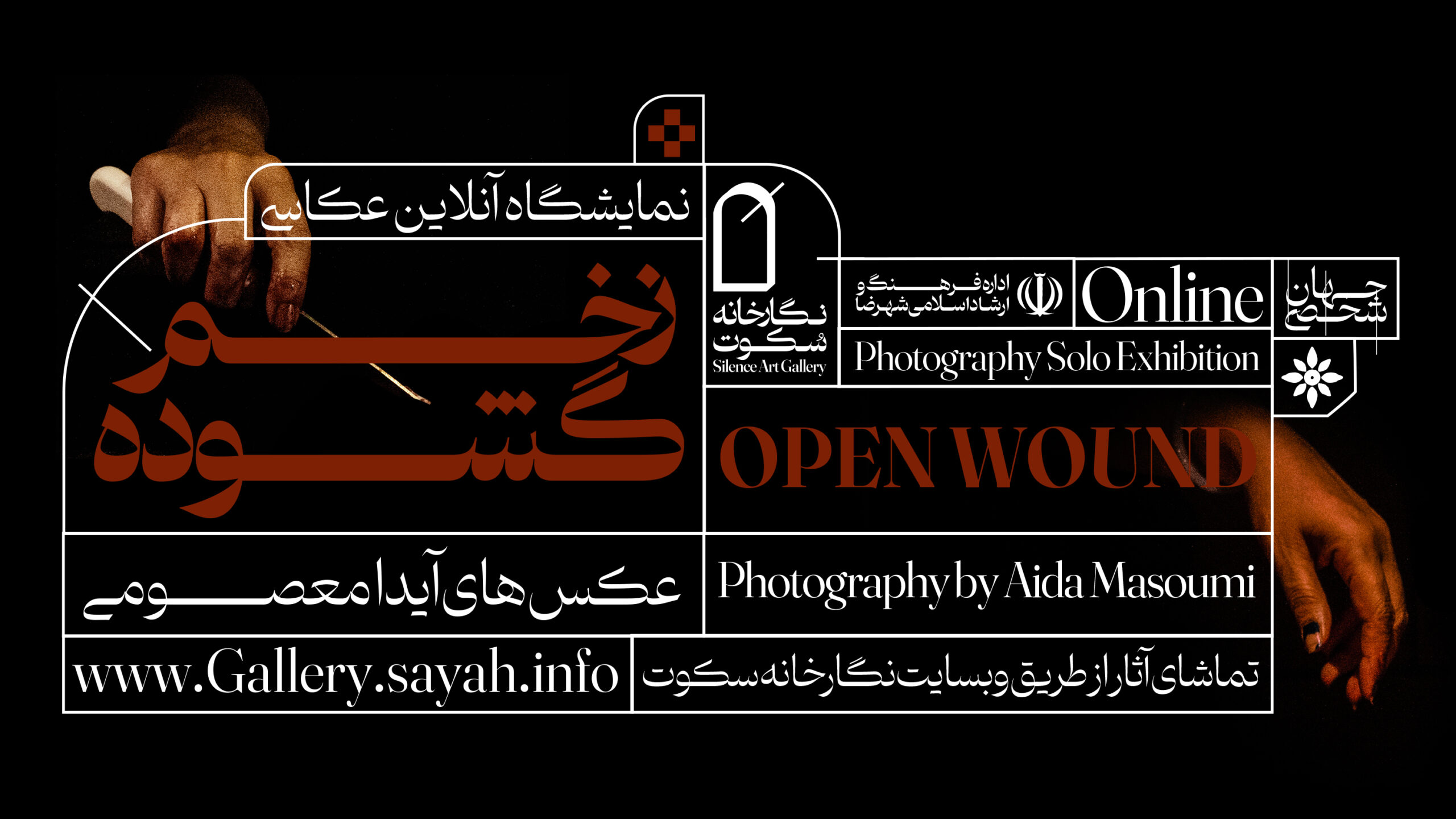 Open wound